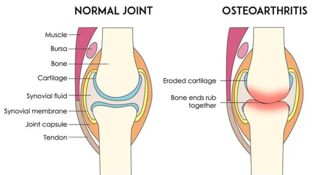 Joint Comparison