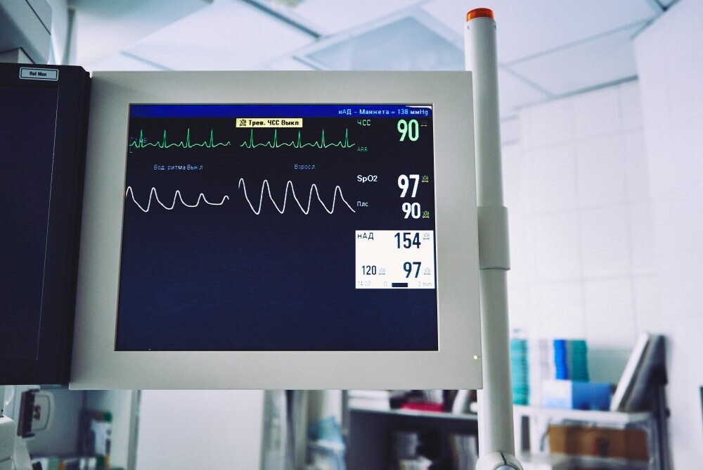 ekg display