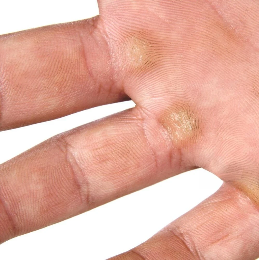 when-callouses-help-grip-performance
