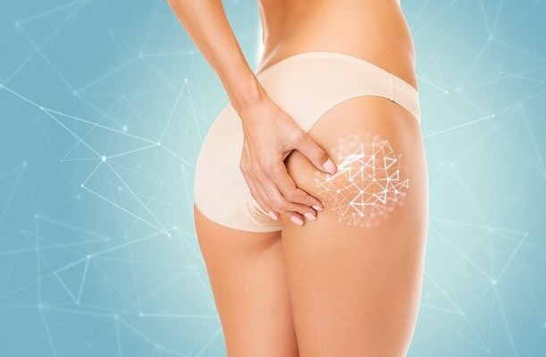 area on the buttocks with cellulite