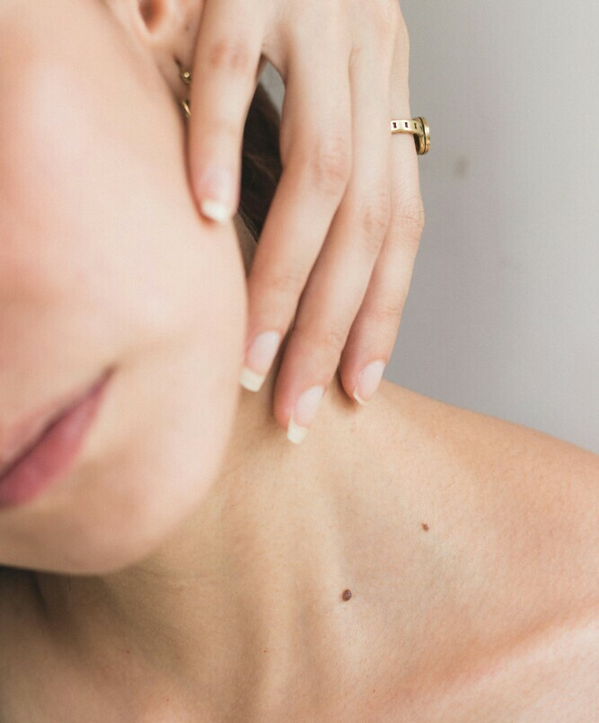stretch marks on a neck